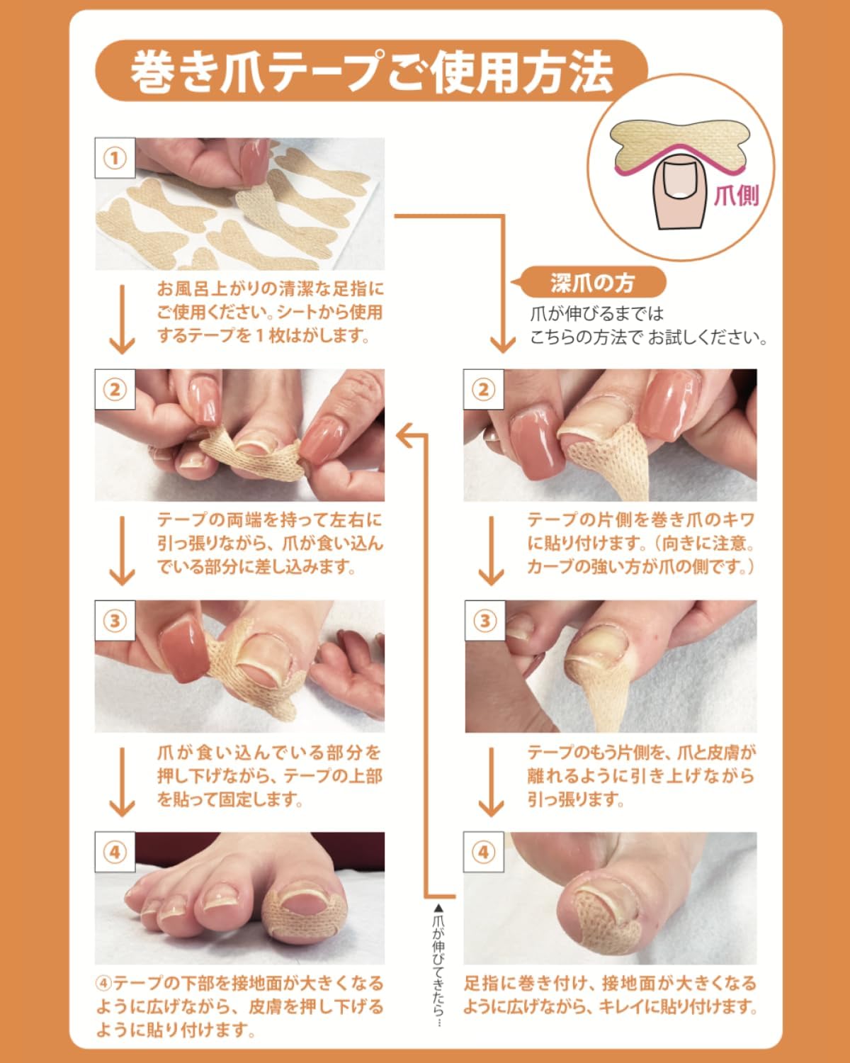 【내성발톱 전문가 감수】 츠메락 내성발톱 테이프 40매